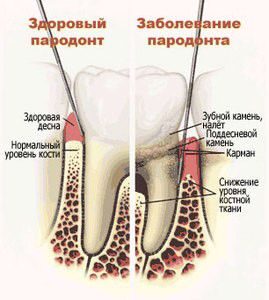 paradontologiya1